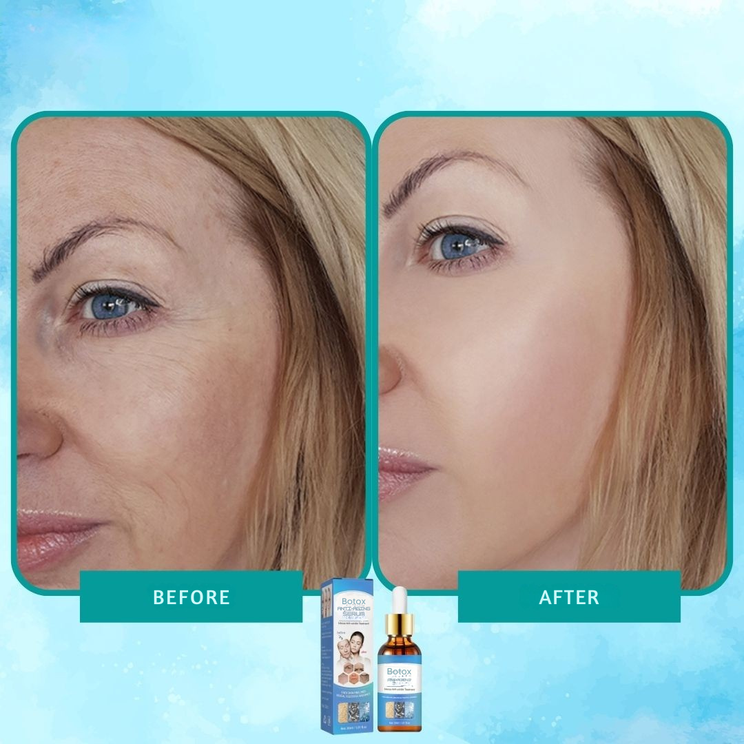 Ser botox elixir anti-riduri intens 