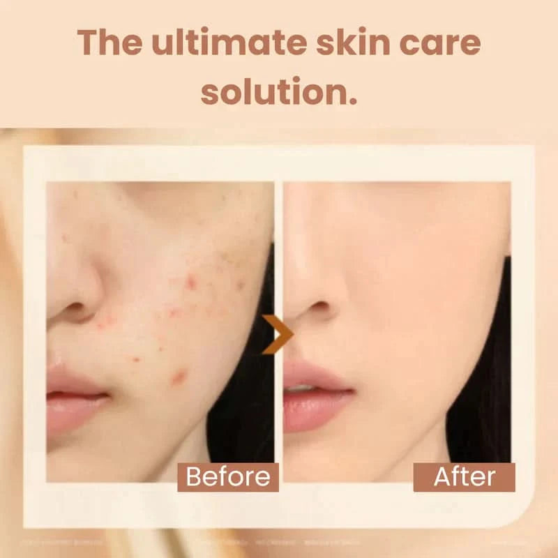 Perfect complexion and instant anti-wrinkle effect 
