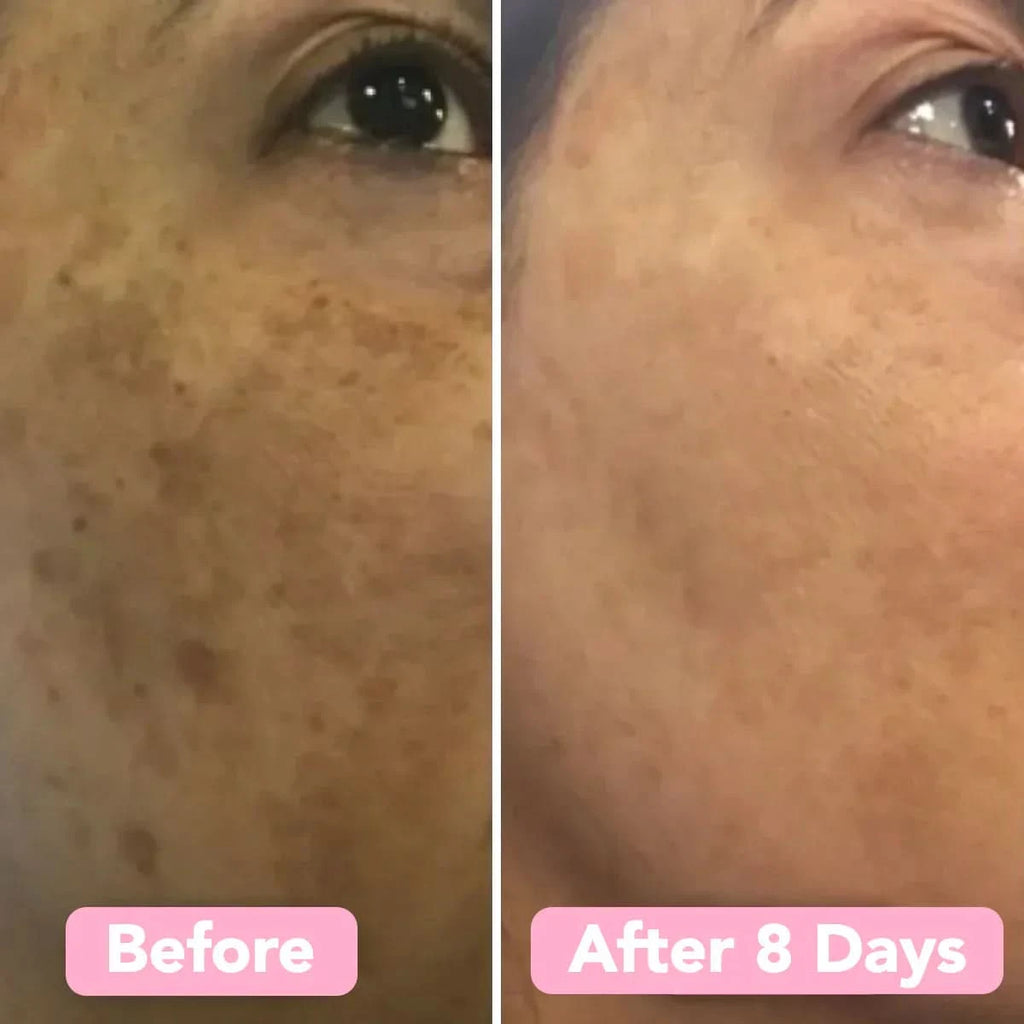 Esponja de cúrcuma – Pele limpa e purificada naturalmente (x40) 