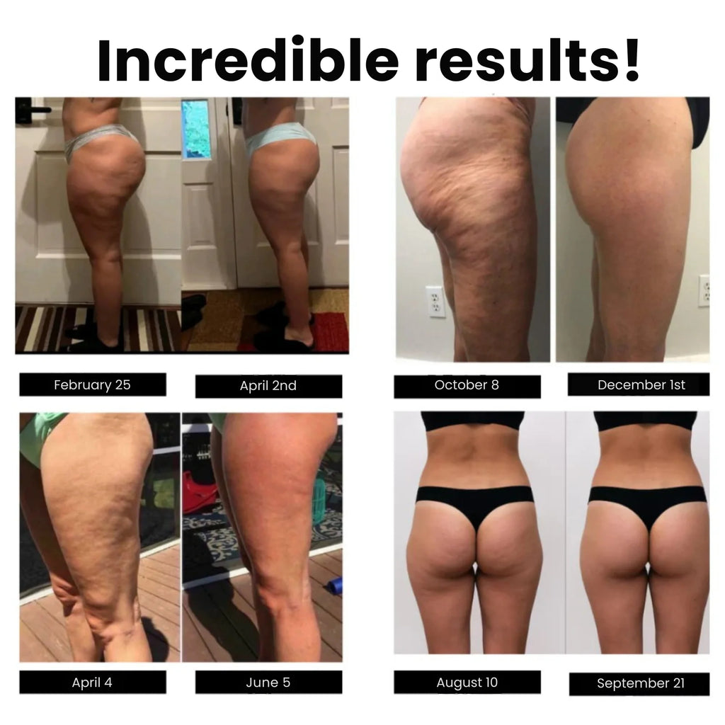 Anti-cellulit-leggings — foto 4